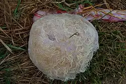 Embryome