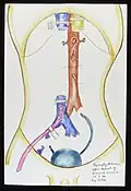 Un abdomen vide pendant une transplantaion de six organes, aquarelle, 1994.