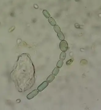 Description de l'image Anabaena20151208152159.JPG.
