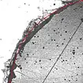 Radiographie d'un os avec des annotation de détection automatique