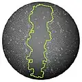 Image noir et blanc au microscope d'un morceau de peau cicatrisant en boîte de Pétri