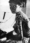 Arménienne torturée et poignardée (18 mars 1911).