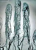 Angiographie des mains avec agrandissement direct et soustraction.