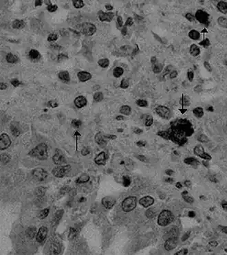 Description de l'image Canine coronavirus.jpg.