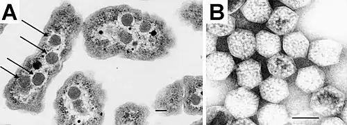 Description de l'image Carboxysomes EM.jpg.