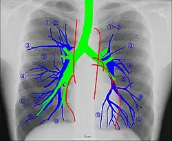 Anatomie radiographique d'une poitrine humaine.