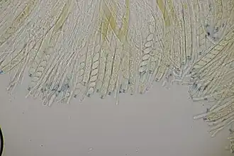 Asques et spores.