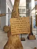 Étiquette explicative sur un fémur brisé