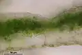 Conocephalum salebrosum, coupe transversale du thalle montrant les cellules photosynthétiques