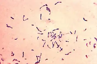 C. diphtheriae d'aspect typique renflé aux extrémités