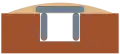 Coupe de ciste enterrée.