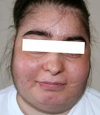 Description de cette image, également commentée ci-après