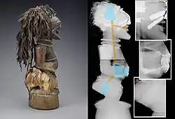 Image radiographique d'une statuette votive Songye de la collection du musée d'art d'Indianapolis.