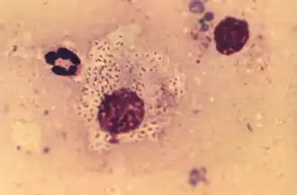 Description de l'image Donovan bodies (Klebsiella granulomatis) PHIL18899.png.