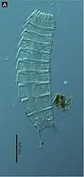 Echinoderes komatsui, un Kinorhyncha