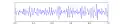 Ondes Gamma.