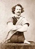 Phocomélie.