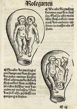 positions fœtales