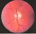Vaisseaux oculaires