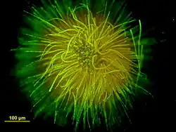 Colonie en forme de boule formée par une des espèces de Gloeotrichia (vue au microscope, avec coloration).
