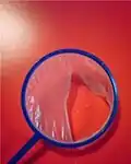 Un poi partiellement déchiré.