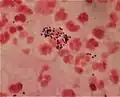 Streptocoques sur fond de PNN Gram –