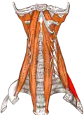 le muscle scalène postérieur.