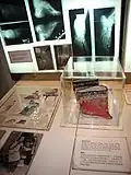 Une exposition sur les pieds bandés.