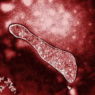 Description de l'image Hallan-en-un-microorganismo-primitivo-una-proteina-capaz-de-reparar-ADN.jpg.