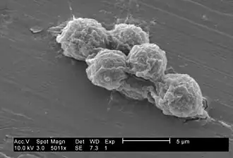 Petit groupe de Trophozoïtes de V. vermiformis (microscope électronique, en 2002, alors appelées Hartmannella vermiformis.
