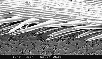 Photomicrographie électronique à balayage de la pointe de l'épillet où l'on voit les micro-barbillons anti-rétrogrades expliquant la possibilité de circulation intracorporelle profonde de l'épillet avec ses dangers pour la santé.