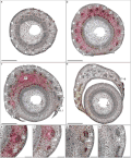 Microphotographie de coupes transversales au niveau de la zone d'insertion des feuilles de Polyscias balfouriana : nœud multilacunaire.