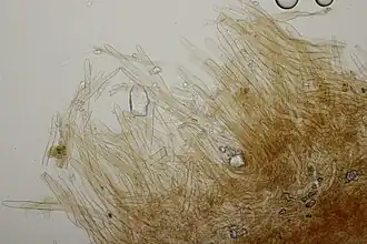 Cellules trichodermiques du pileus