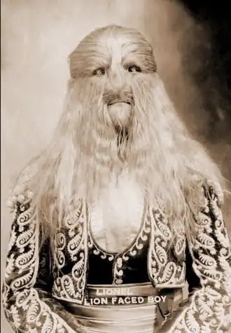 Lionel, l'homme à la tête de lion.