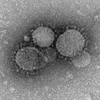 Description de l'image MERS-CoV electron micrograph1.jpg.