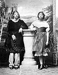 Maximo et Bartola, atteints de microcéphalie.