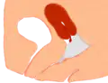 Coupe menstruelle positionnée trop loin dans le vagin, risque de fuite