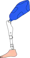 L'emboîture est en bleu.