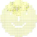 Clone du Démineur non rectangulaire.