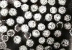 Image illustrative de l’article Diarrhée