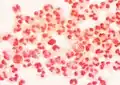 N. gonorrhoeae sur fond de PNN Gram –