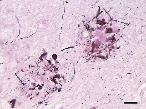 Deux zones arrondies formées de taches rouge sombre irrégulières groupées autour de plages rose uniforme et structures filamenteuses très foncées sur un fond rose clair non homogène.