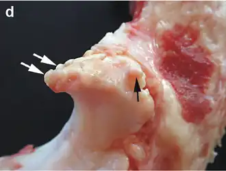 Description de l'image Osteophytes processus anconeus.png.