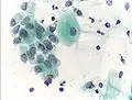 Cellule endocervicale indispensable pour être sûr de la qualité du frottis.