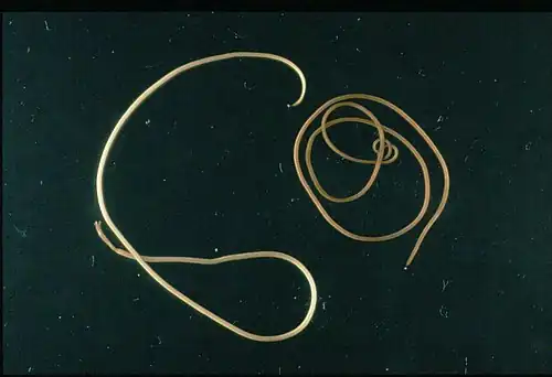 Paragordius tricuspidatus, un Nematomorpha, autre groupe de vers ronds.
