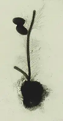 Description de l'image Paraphysomonas butcheri whole mount.jpg.