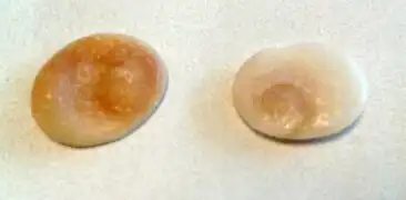 Opercules