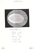 Image axiale historique (1er Cone-Beam 3D Scan fait le 1er juillet 1994