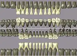 Notation ISO pour les dents temporaires