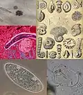 Protozoa.